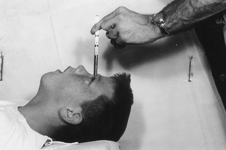 howard_dully_during_ice_pick_lobotomy_dec_16_1960